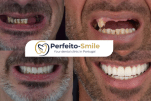 dental implant Portugal: accessible and affordable