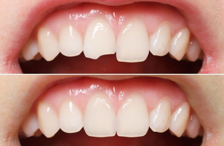 Affordable dental care abroad