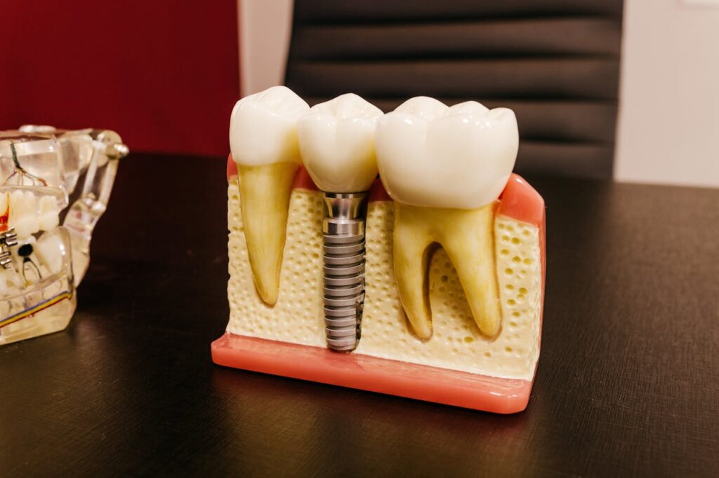 implants dentaires Portugal