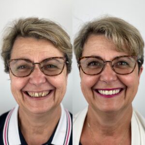 se refaire les dents au Portugal pour les canadiens