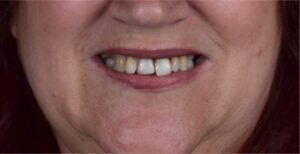 histoires de français soins dentaires pportugal