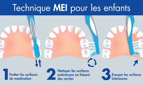 nettoyer les dents des bébés de 1 à 3 ans 