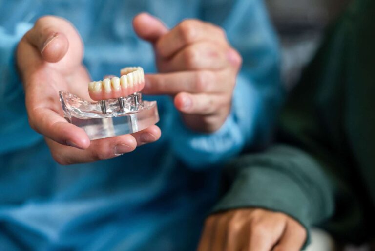 high-end quality dental implants Portugal