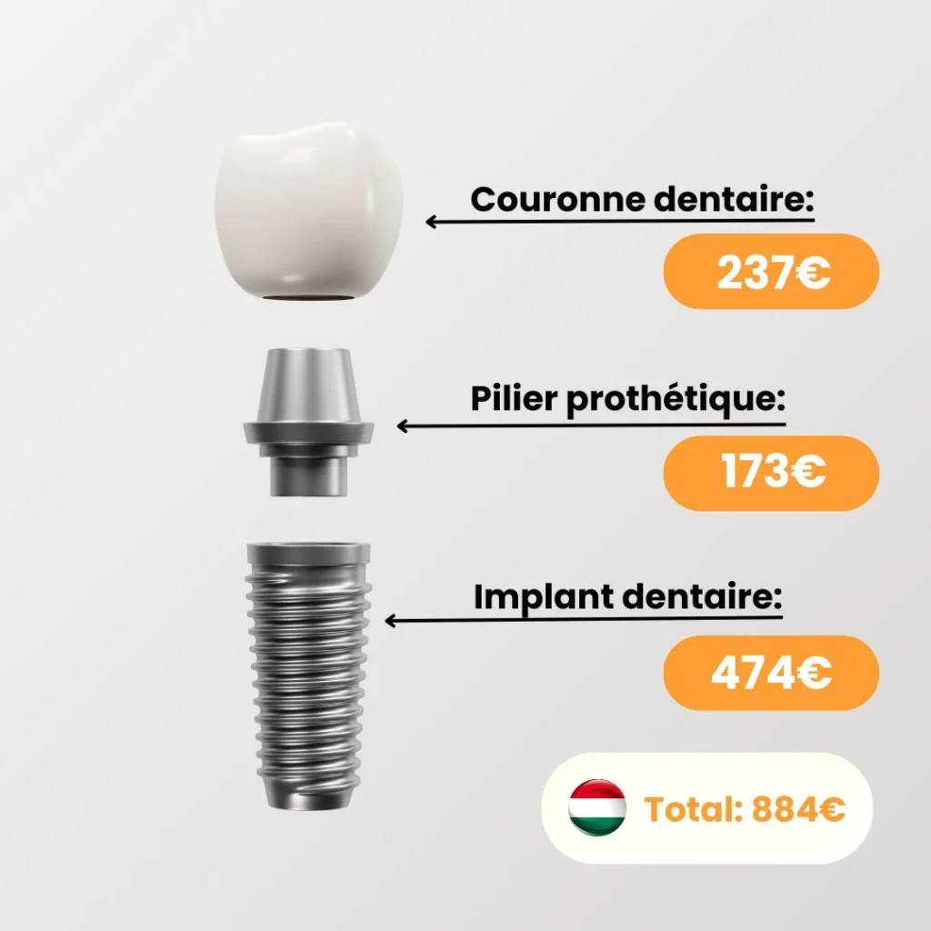 Comparatif des prix des soins dentaires Portugal sans mutuelle versus France