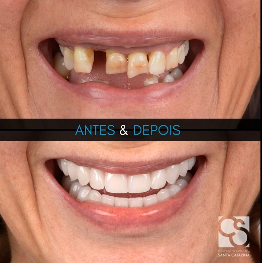 clinique dentaire santa catarina à porto