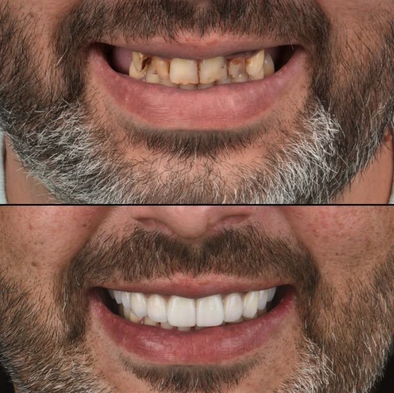 Is Dental Tourism in Portugal Safe? 7 Safety Checks Before You Book