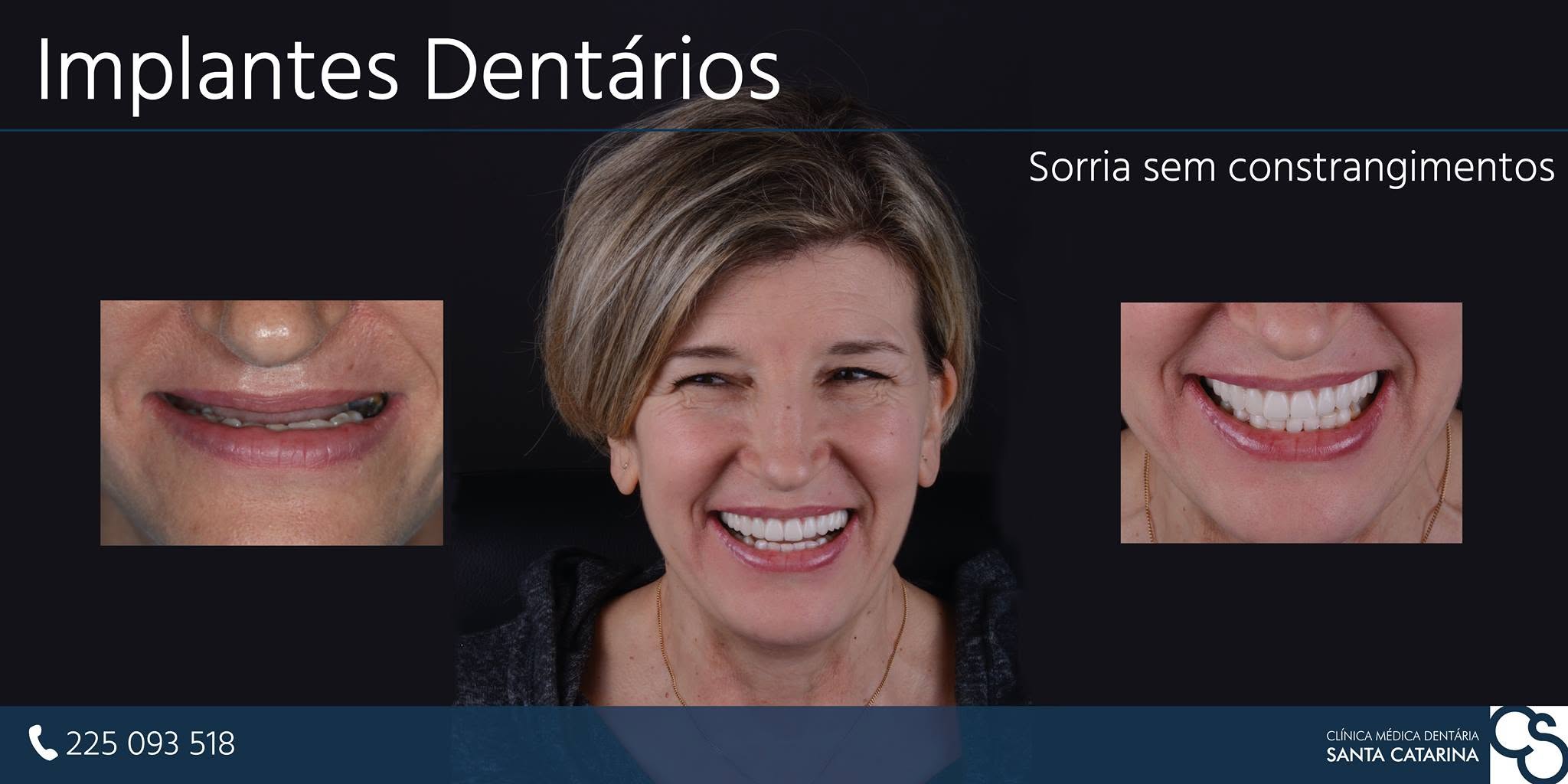 Patiente souriante après ses soins dentaires à Porto, comparatif implant dentaire France Portugal Hongrie Turquie