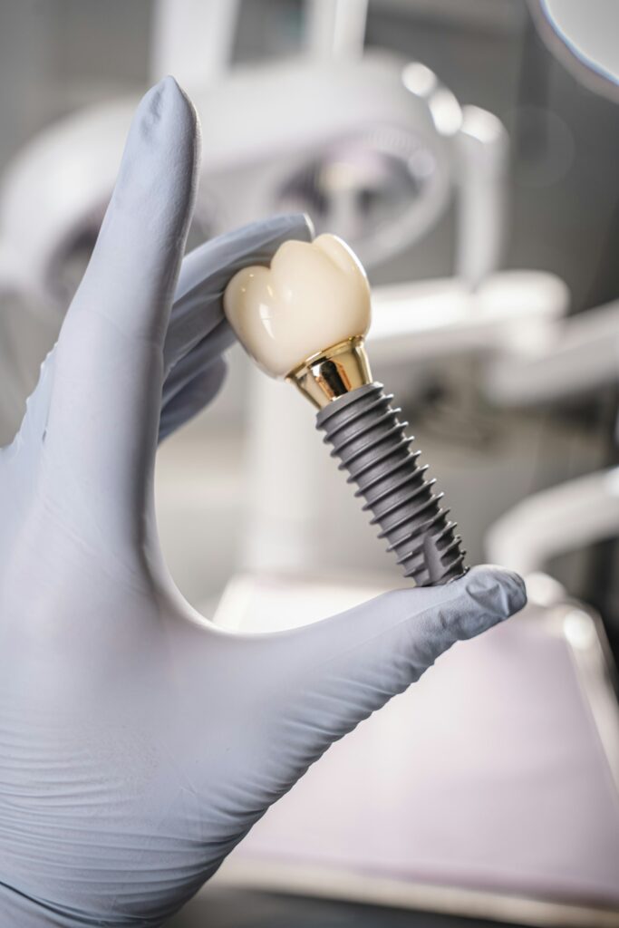 how long do dental implants last