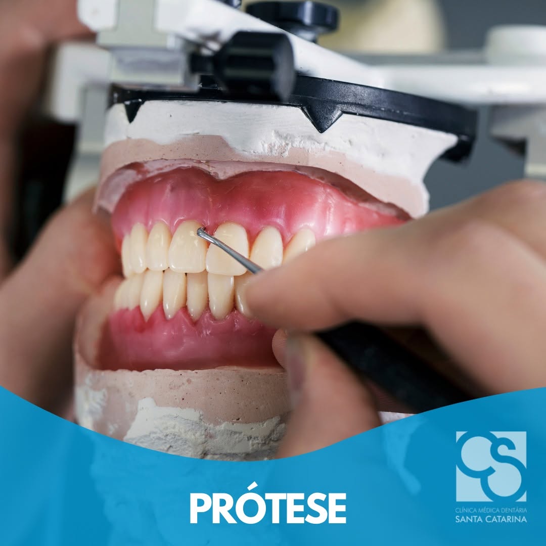 Removable dental prosthesis in Porto, Portugal – Restoring smile and chewing function