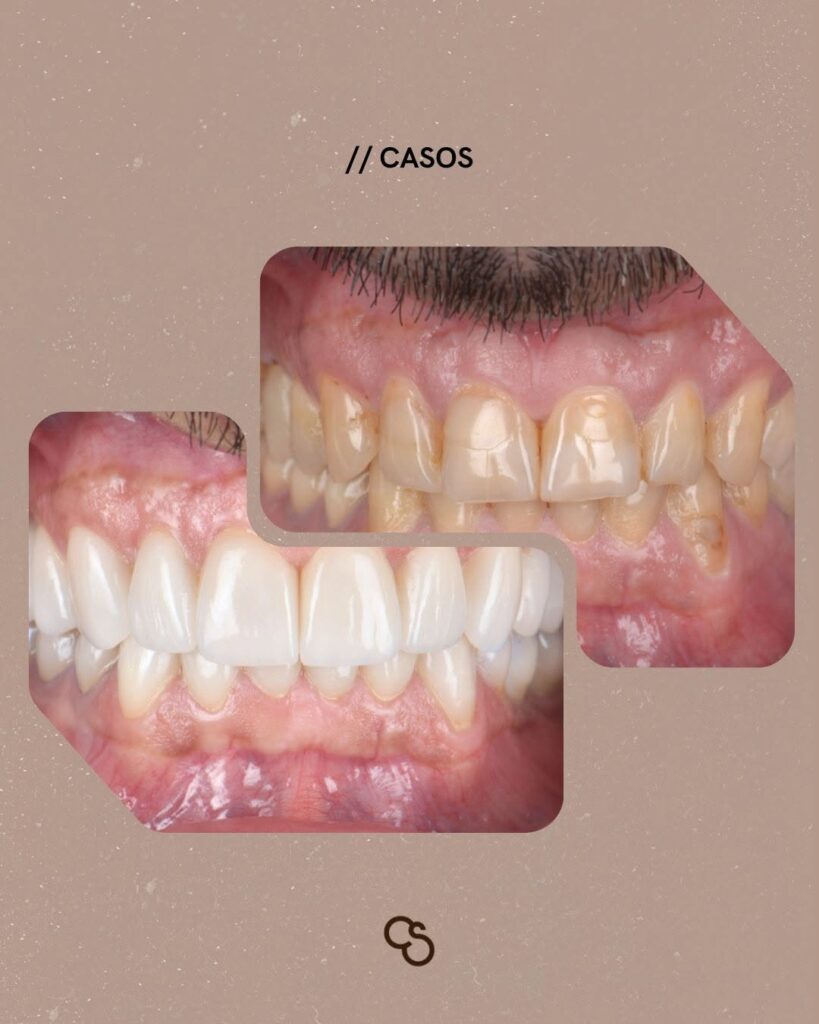 Smile transformation through personalised treatment in Porto, Portugal
