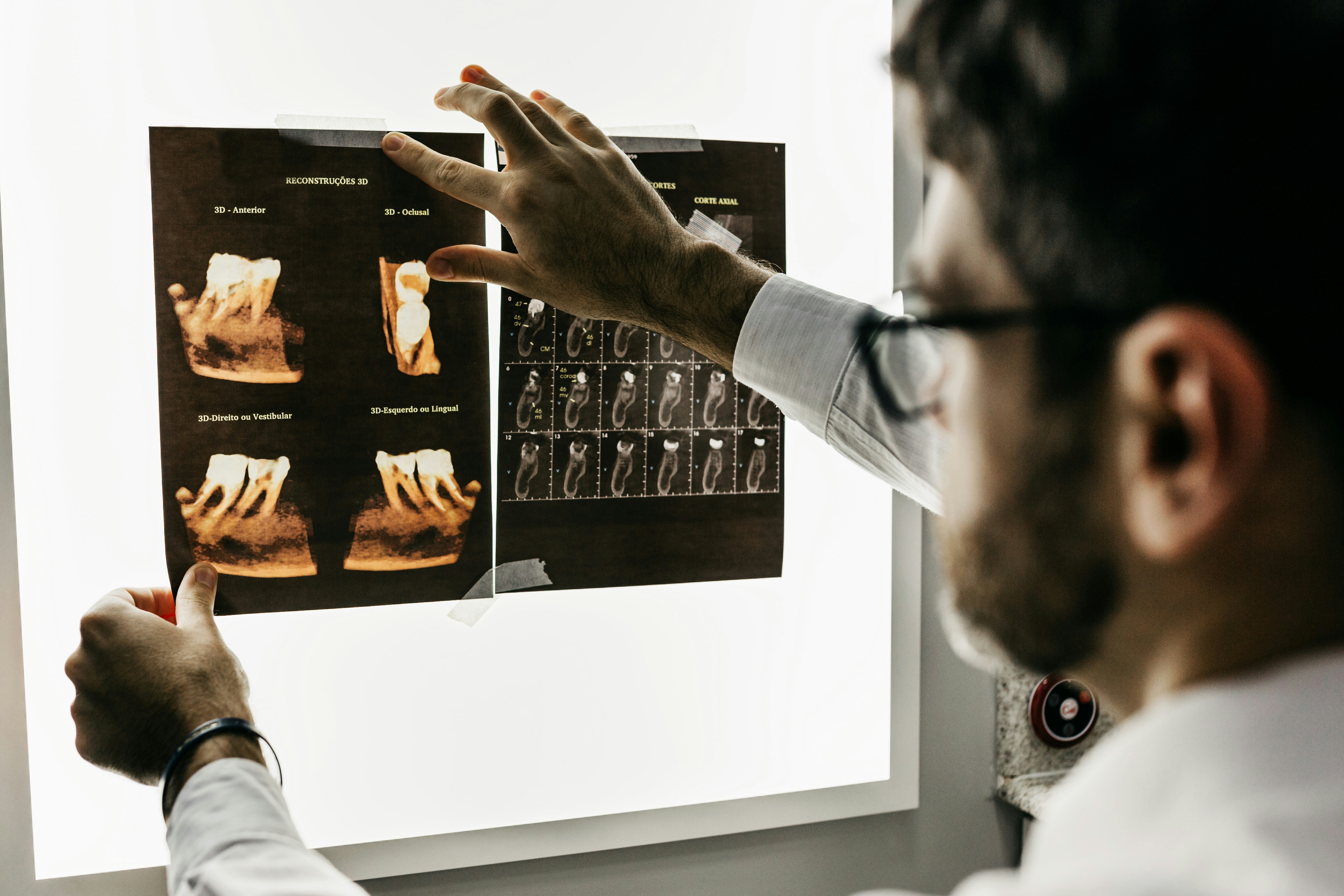 Radio panoramique dentaire vs CBCT 3D – comparatif prix et dose en France