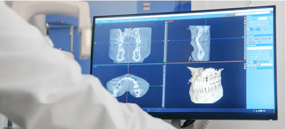 Appareil de radiographie panoramique numérique à la clinique dentaire de Porto